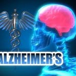 alzheimers